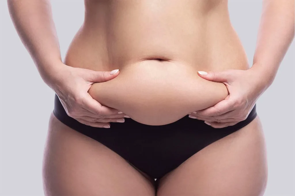 Tummy tuck vs. mini tummy tuck