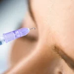 Faltenbehandlung