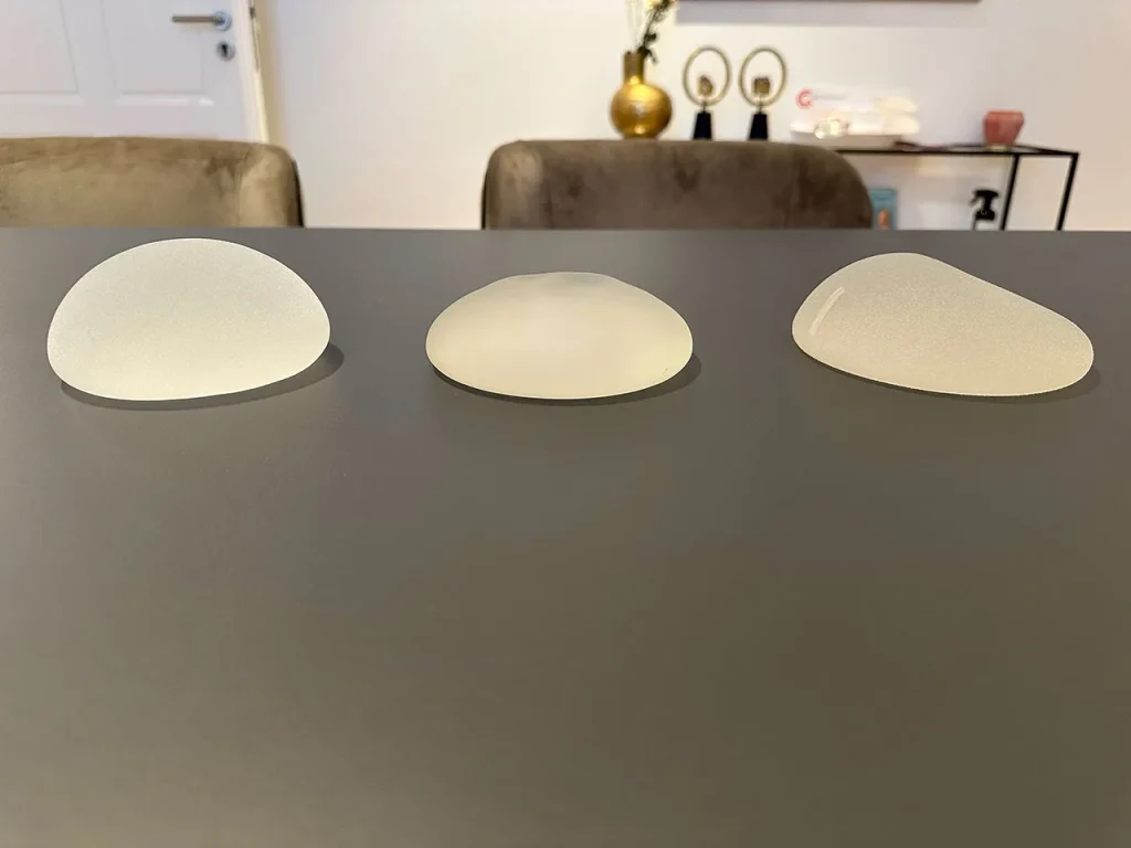 Brustvergrößerung mit Implantaten