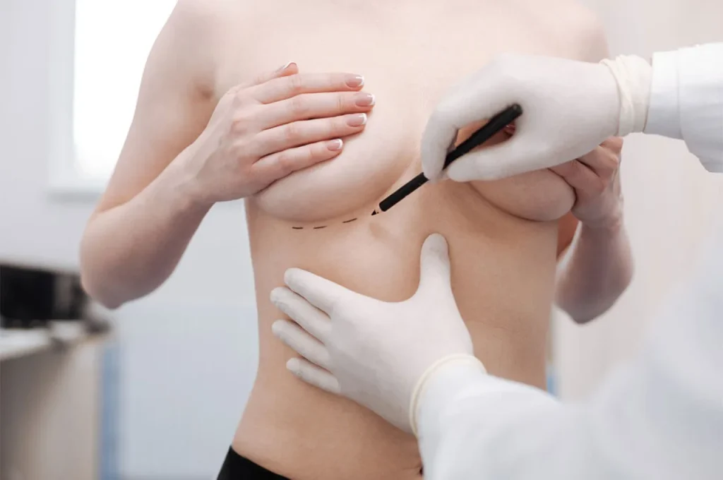 Breast lift in Frankfurt: Dr. Emmanouil Nichlos