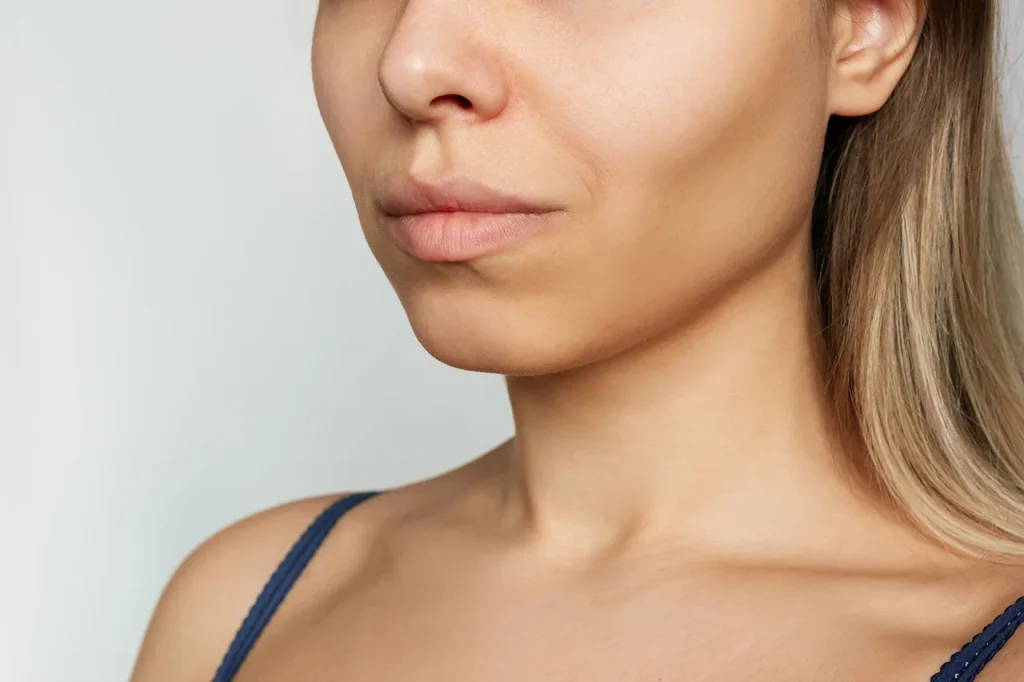 Buccal fat removal