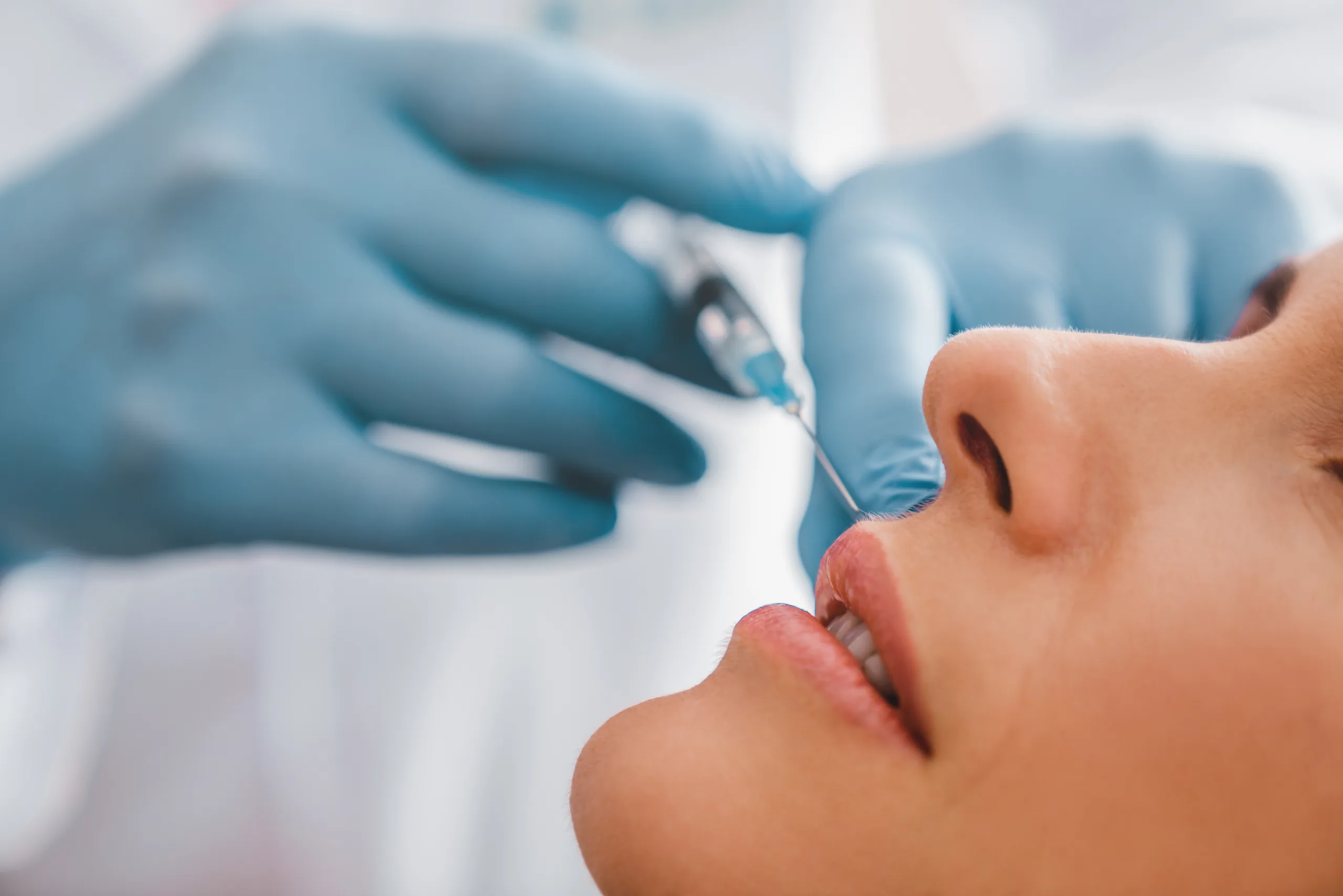 Lippen aufspritzen: Hyaluronsäure-Behandlung in der Praxis von Dr. Nichlos in Frankfurt